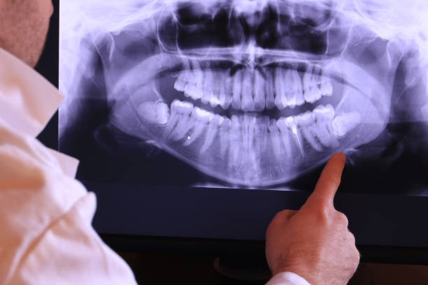 Best 24-Hour Emergency Dentist in Egan, LA