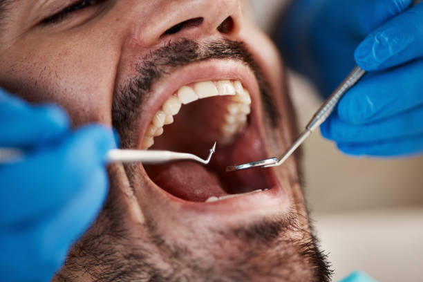 Best After-Hours Dental Trauma Care in Egan, LA